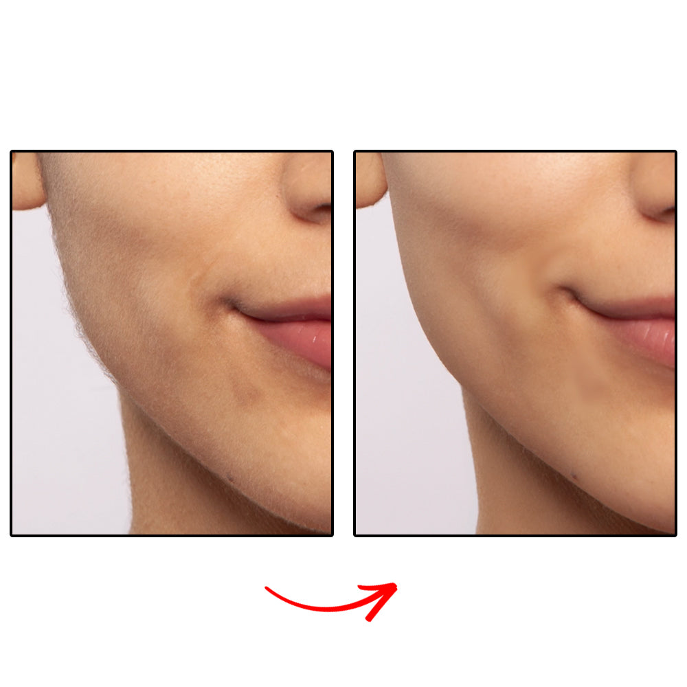 Removedor de Pelos Faciais ProDesign